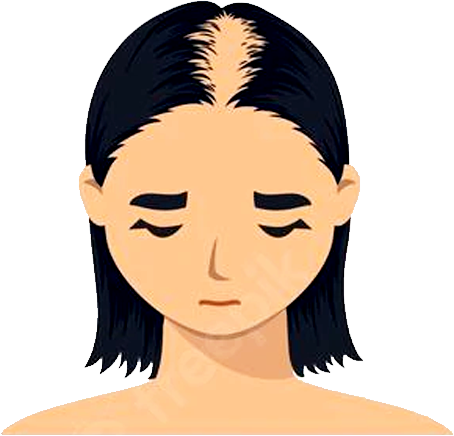 stage-2-female-pattern-baldness