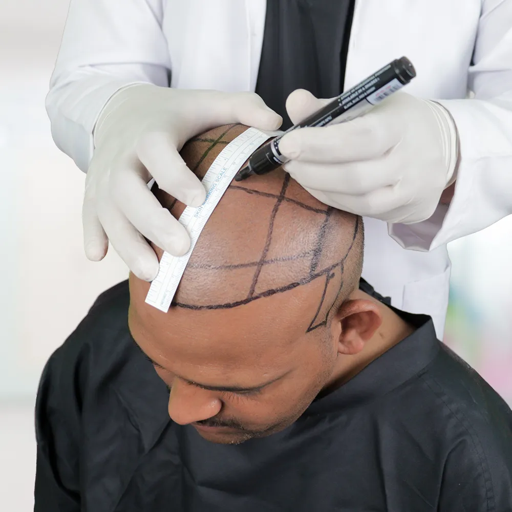 Hairline Marking