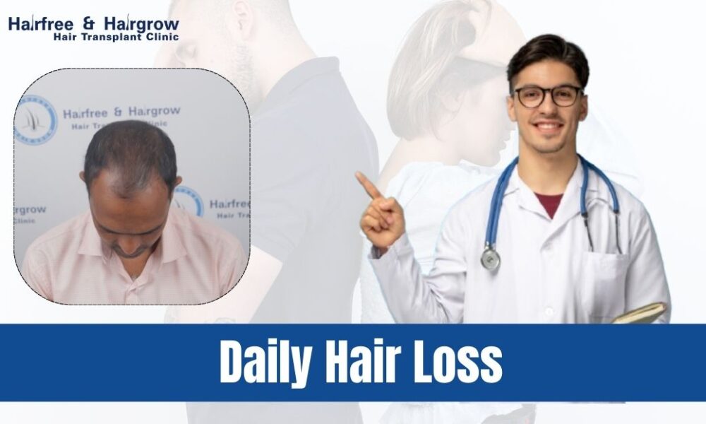 Daily Hair Loss