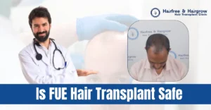 is-fue-hair-transplant-safe