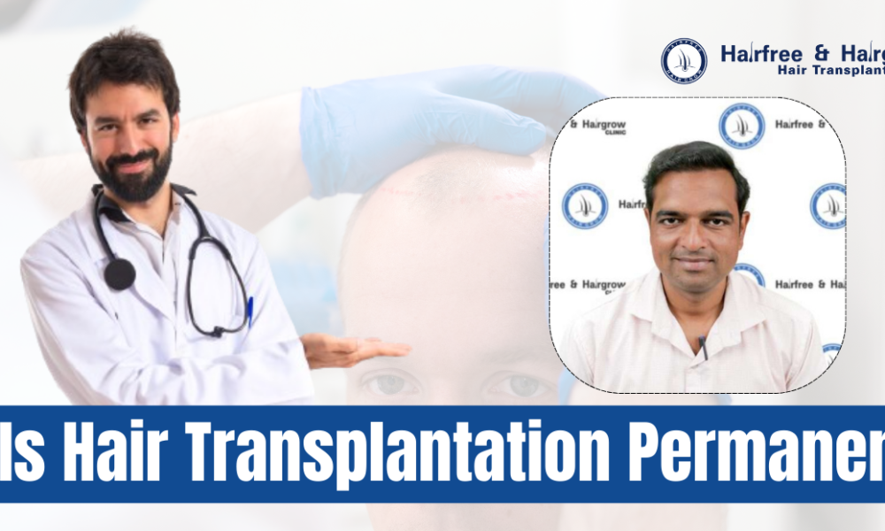 is-hair-transplantation-permanent