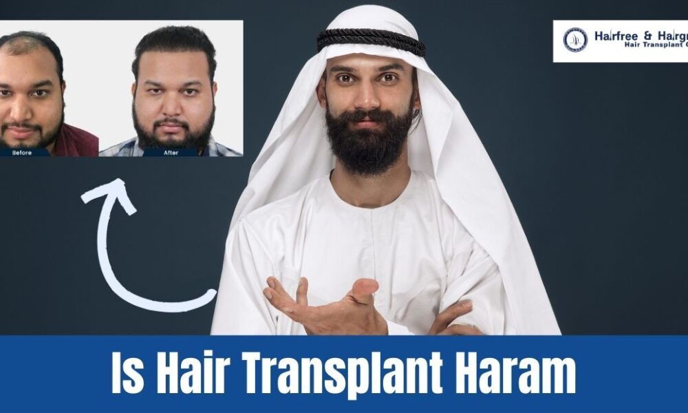 is+hair+transplant+haram