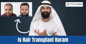 is+hair+transplant+haram