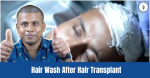 Hair Wash After Hair Transplant