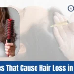 Illnesses That Cause Hair Loss in Women