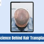 Science+Behind+Hair+Transplants