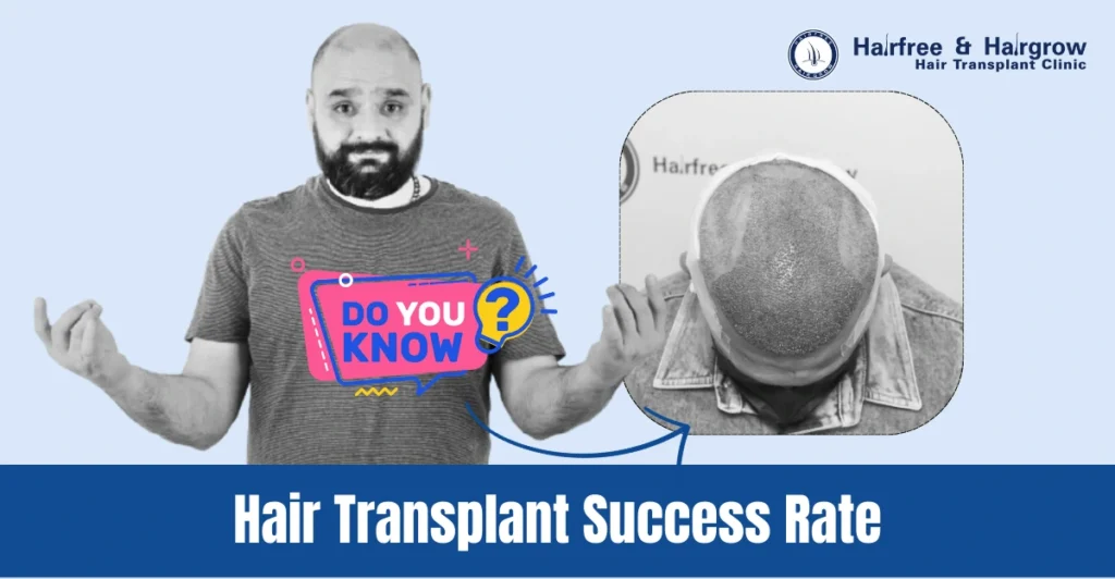 Hair Transplant Success Rate