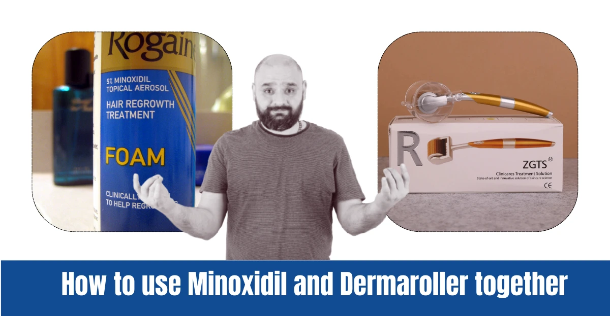 How do you use Minoxidil and Dermaroller together?