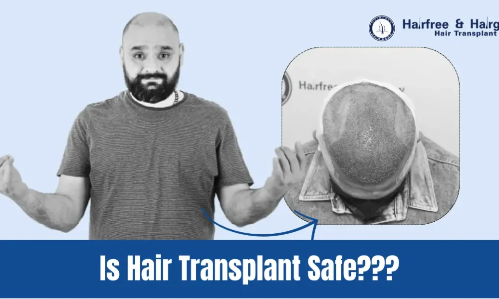 Is Hair Transplant Safe