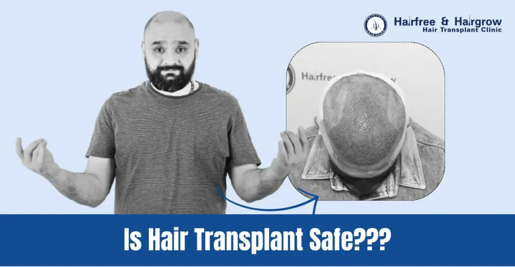 Is Hair Transplant Safe