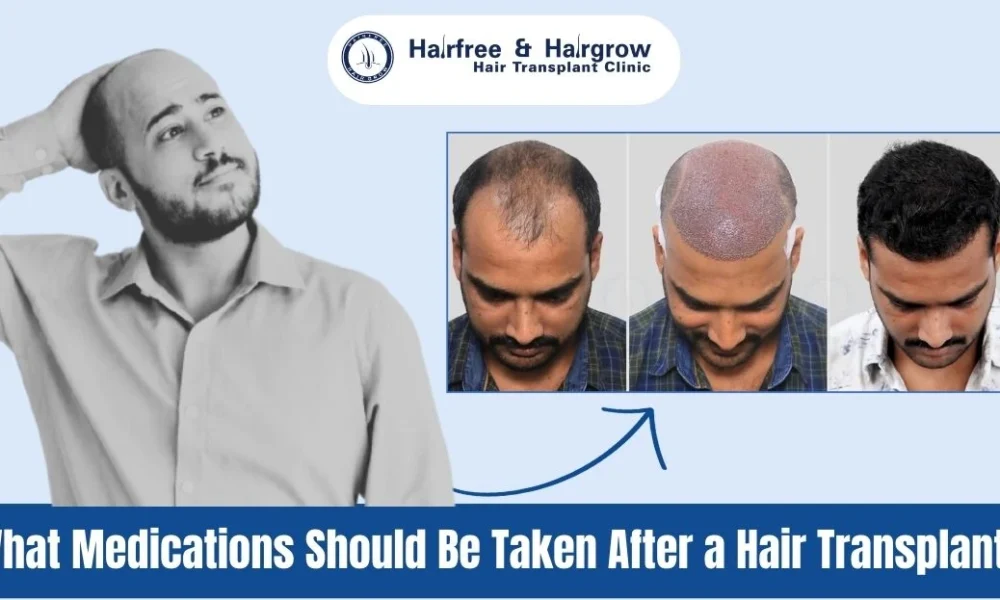 What Medications Should Be Taken After a Hair Transplant