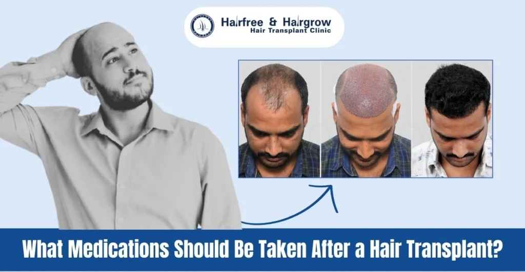 What Medications Should Be Taken After a Hair Transplant