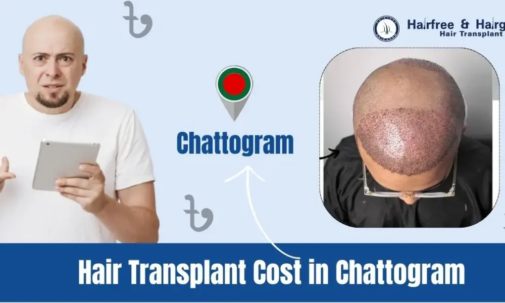 Hair Transplant Cost in Chattogram
