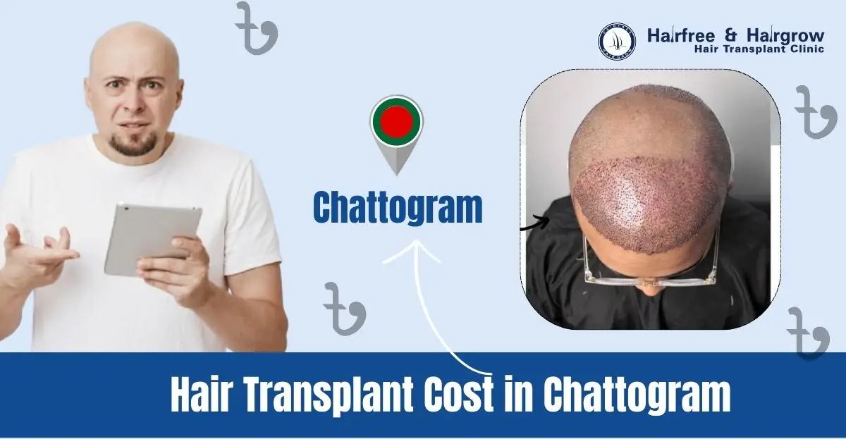 Hair Transplant Cost in Chattogram: Get Your Price