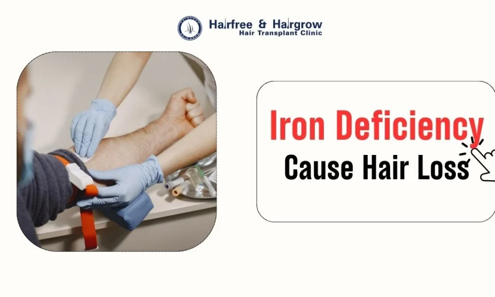 Can-Iron-Deficiency-Cause-Hair-Loss