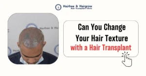 Can You Change Your Hair Texture with Hair Transplant