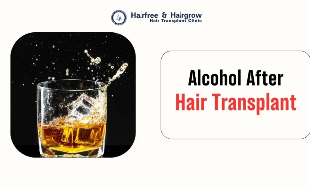 Alcohol After Hair Transplant
