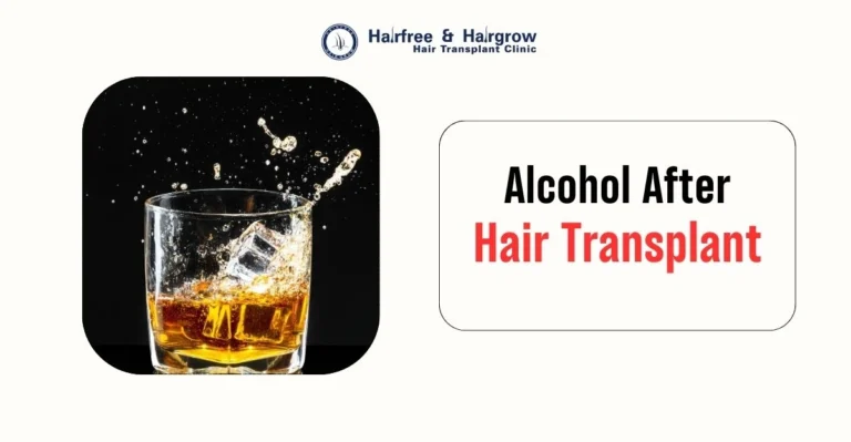 Alcohol After Hair Transplant