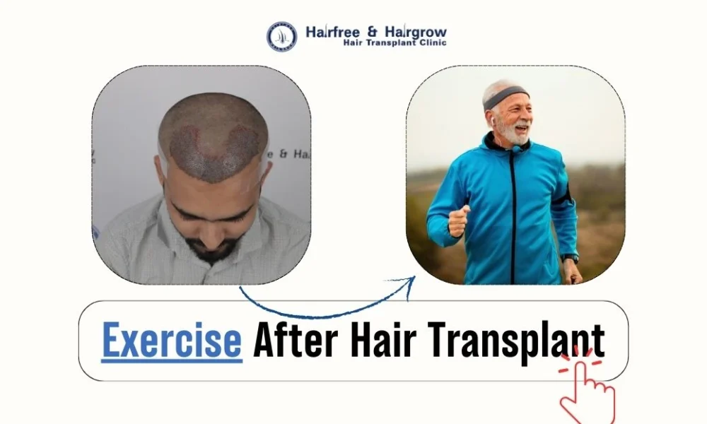 exercise+after+hair+transplant