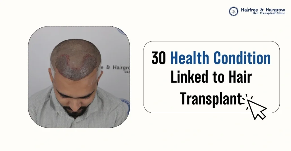 30 Health Conditions Linked to Hair Transplant