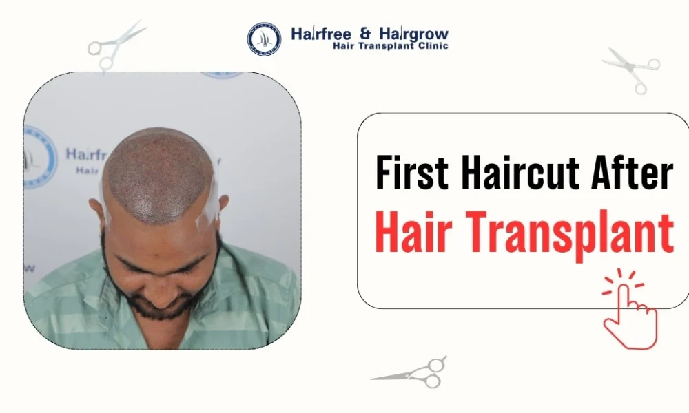 first-hair-cut-after-hair-transplant