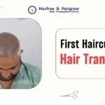 first-hair-cut-after-hair-transplant