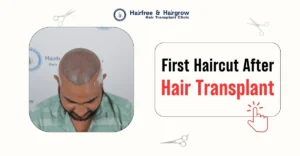 first-hair-cut-after-hair-transplant