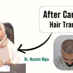 Hair Transplant Aftercare Tips From Dhaka Experts