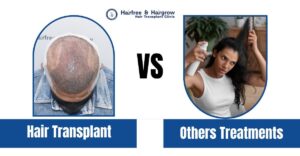 Hair Transplant and Other Hair Loss Treatments in Dhaka