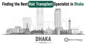 FindingtheBestHairTransplantSpecialistindhaka