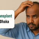 Is Hair Transplant Safe in Dhaka