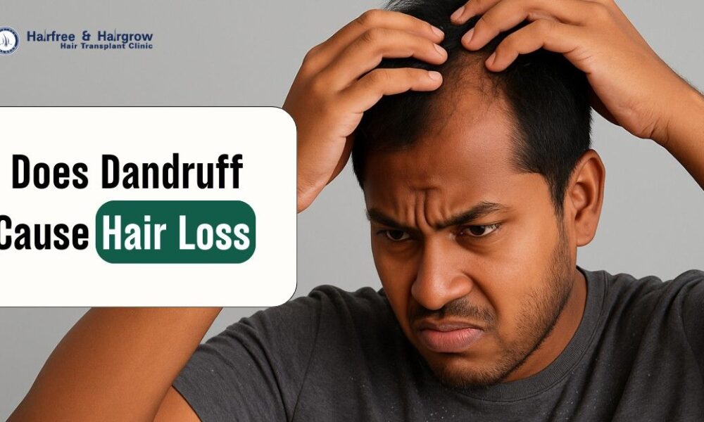 Does Dandruff Cause Hair Loss​ in Bangladesh