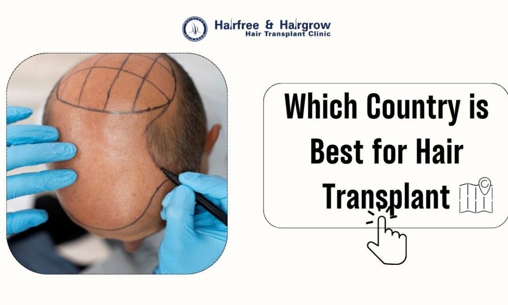 Which Country is Best for Hair Transplant