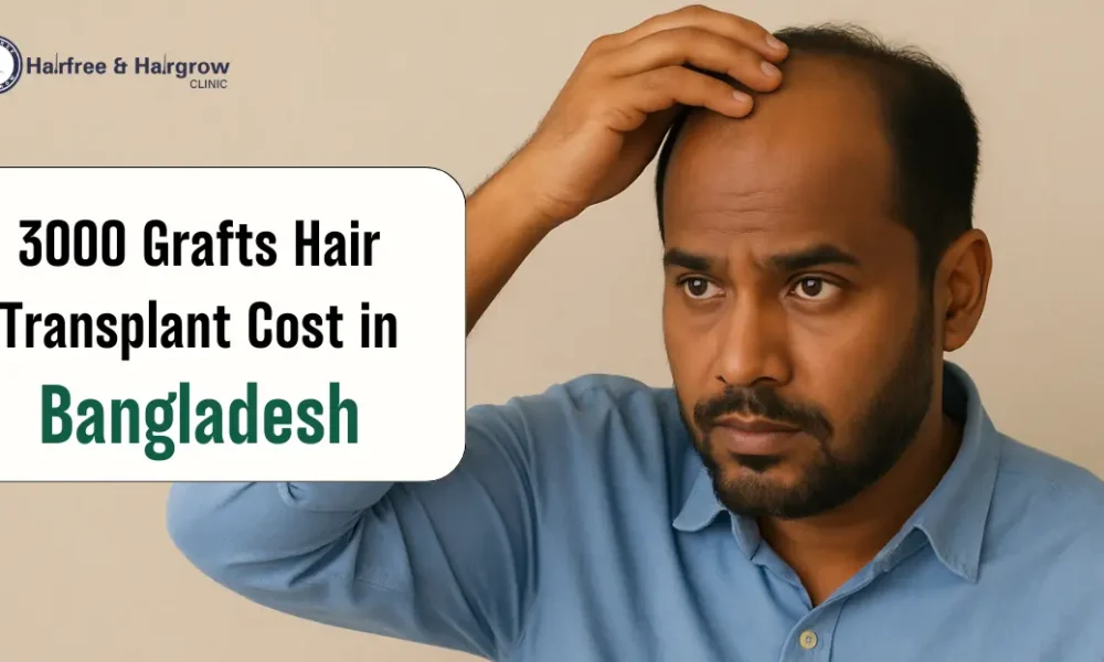 3000 Grafts Hair Transplant Cost in Bangladesh