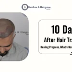 10 Days After Hair Transplant