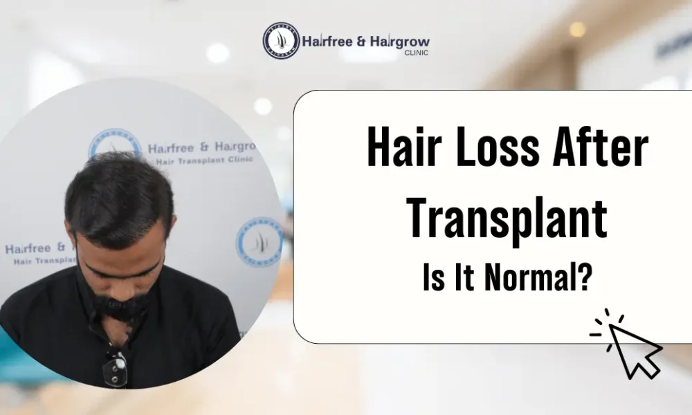 Hair Loss After Transplant