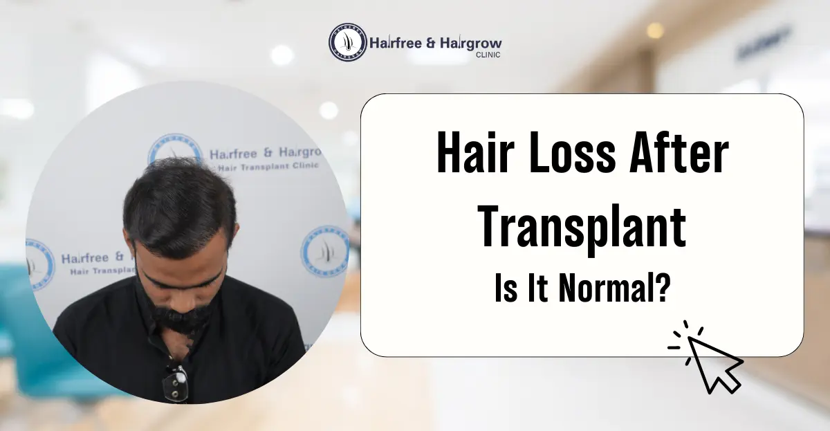 Hair Loss After Transplant
