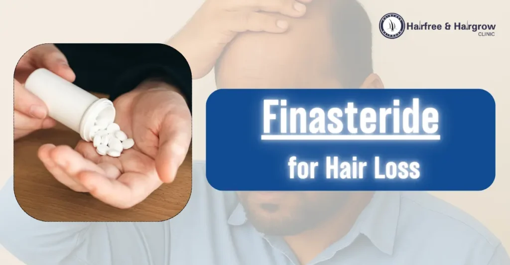 Finasteride for Hair Loss