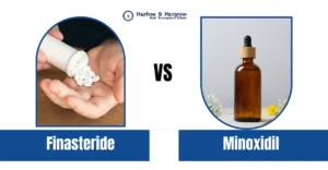 Hair Loss 8 Finasteride vs Minoxidil