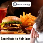 Foods That Can Contribute to Hair Loss