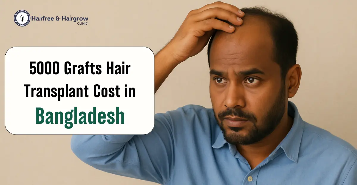 5000 Grafts Hair Transplant Cost in Bangladesh