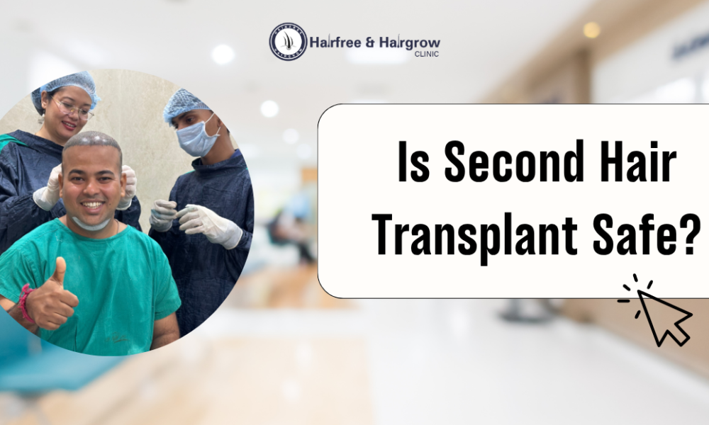 Second Hair Transplant Safe