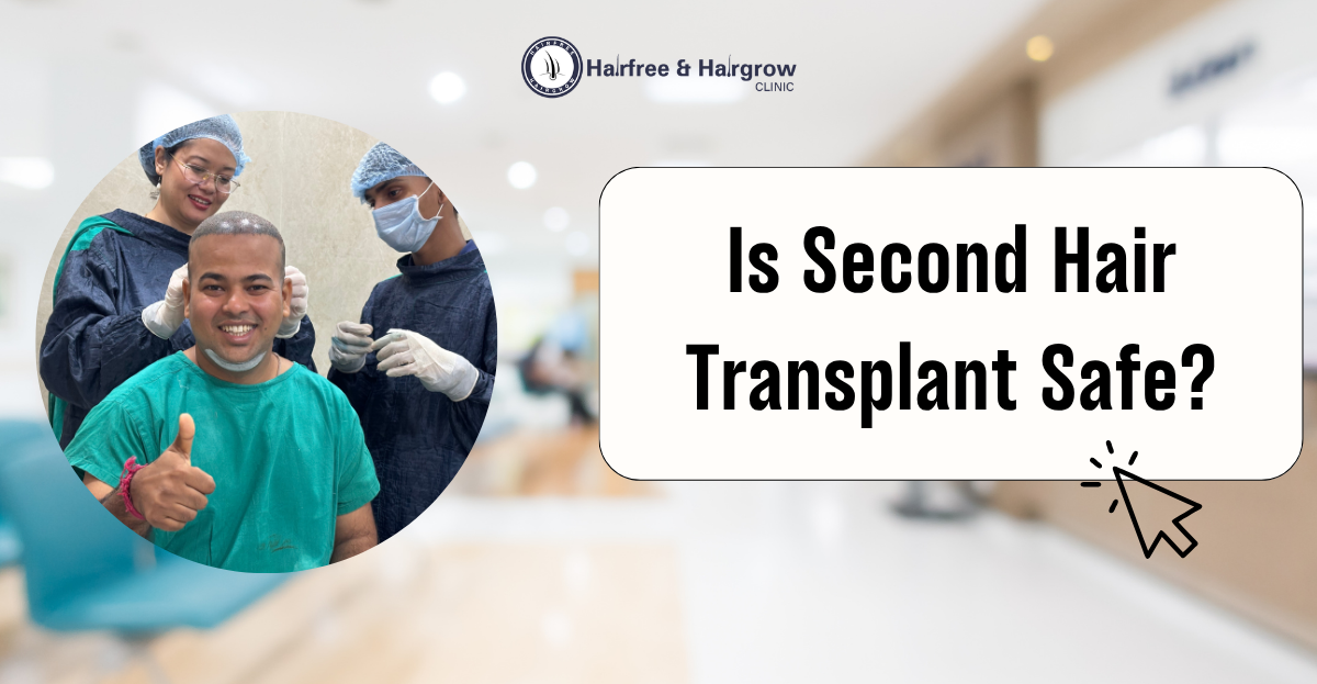 Second Hair Transplant Safe