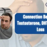 Connection Between Testosterone, DHT, and Hair Loss