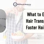 What to Eat After Hair Transplant for Faster Hair Growth