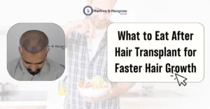 What to Eat After Hair Transplant for Faster Hair Growth