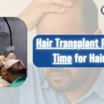 Hair Transplant in Dhaka