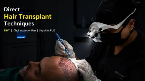 Direct Hair Transplant Techniques