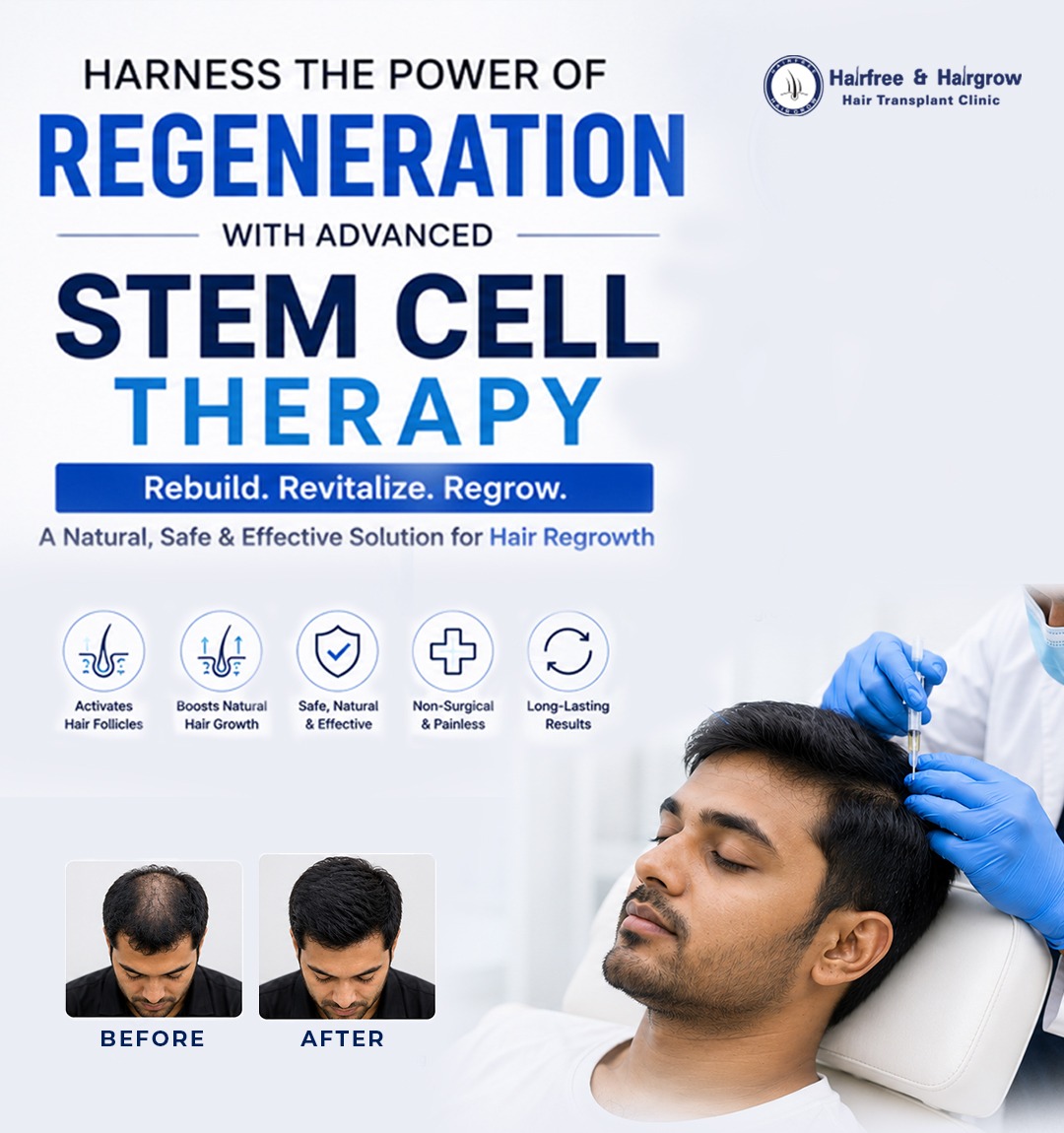 stem cell therapy hair loss bangladesh hairfree hairgrow.jpg