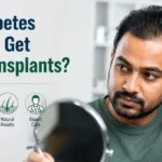 Can Diabetes Patients Get Hair Transplants